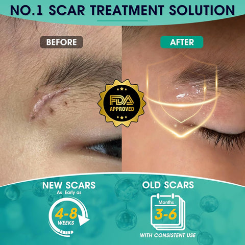 Gel ScarMD Fórmula avanzada para Cicatrices y Manchas 6gr - Indigo72.com
